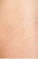 photo texture of scarred skin 0009